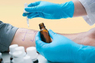 Проведение аллерготеста Аллерготест