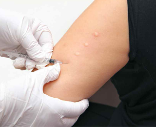 Проведение прик-теста Прик-тест