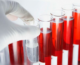 Общий анализ крови на аллергию Анализ крови