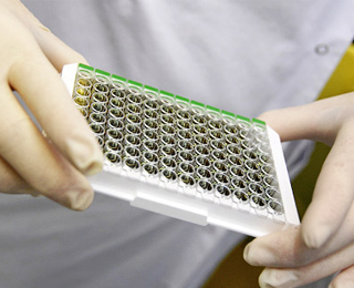 Иммуноферментный анализ крови Анализы