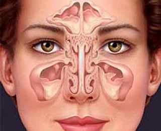 Вазомоторный аллергический ринит Вазомоторный ринит