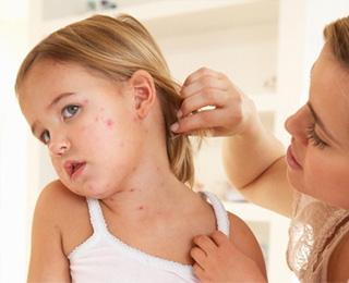 Дерматит как клиническое проявление заболевания Дерматит