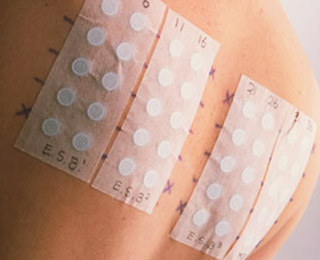 Аппликационная проба Проба