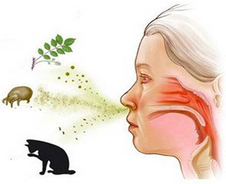 Аллергены Аллергия