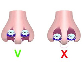 Правильное применение фильтра Применение фильтра