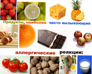 Факторы способствующие развитию приобретенной аллергии Из-за чего может возникнуть аллергия