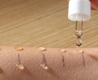 Кожные пробы на аллергию Кожные пробы