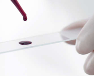 Анализы крови на выявление аллергии Анализ