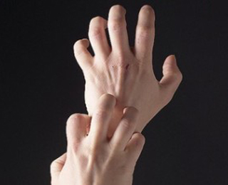 Первые проявление аллергической реакции Зуд на коже