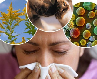 Виды аллергенов Аллергены