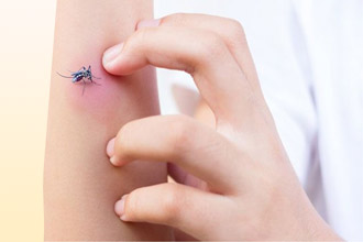 аллергия на укус комара