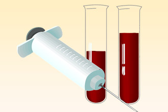Общий анализ крови – безопасный метод лабораторной диагностики Анализ крови