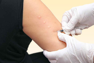 Прик-тест - самая безопасная кожная проба Прик-тест