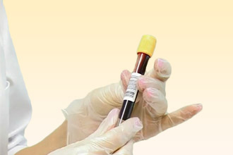 Общий анализ крови Анализ крови