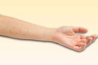 Провокационные пробы – один из диагностических методов Провокационные пробы