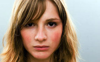 Пищевые продукты часто выступают в роли аллергена. Аллергия