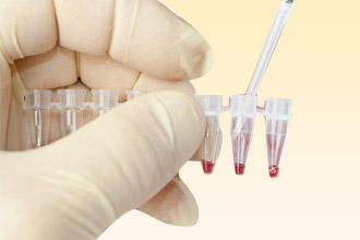 Лабораторные тесты - наиболее безопасный вариант диагностики Лабораторные тесты