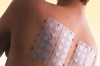 Провокационные тесты помогают выявить чувствительность на аллерген Провокационные тесты