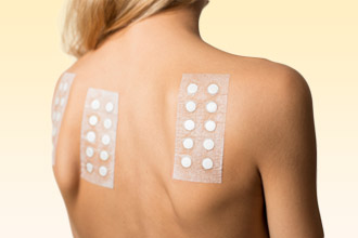 Кожные пробы позволяют выявить аллерген Кожные пробы