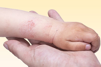 Аллергия на глицин у ребенка Аллергия у ребенка