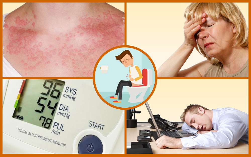 Симптомы аллергии на глицин Симптомы