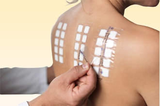 Кожные пробы – один из точных способов диагностики Кожные пробы