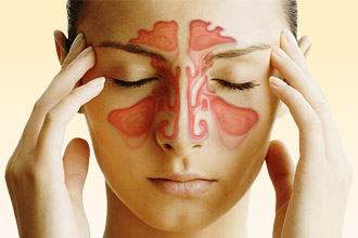 Ринит относится к первой группе признаков аллергии Ринит