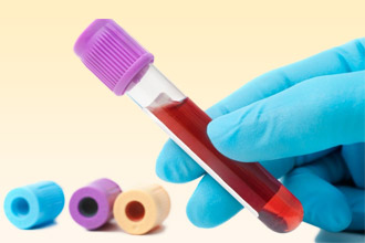 Лабораторный анализ крови позволяет выявить антитела Анализ крови