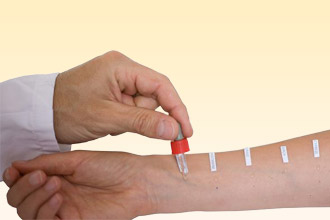 Кожные аллергопробы