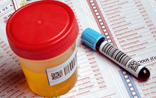 Общие анализы Анализы