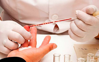 Сдача анализа крови из пальца Общие анализы