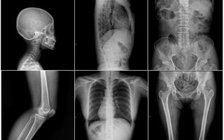 Рентгенография Дополнительные анализы