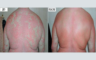 Результат применения средства Свойства препарата