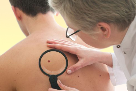 Осмотр у дерматолога