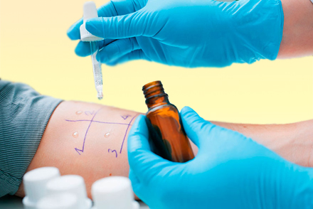 Кожные пробы Диагностика аллергии