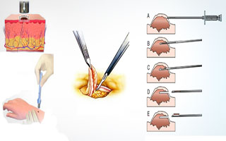 Биопсия кожи Диагноз