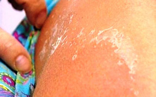 Устранение зуда и шелушения Эффект препарата