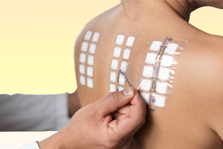 Кожные пробы Тест на аллергнены