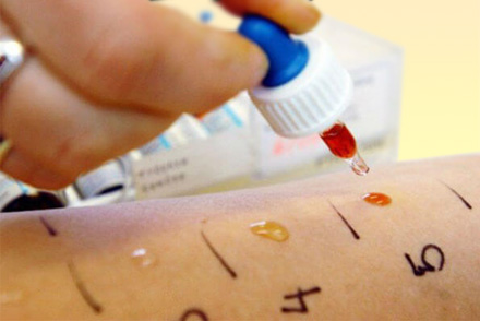 Кожно-аллергические пробы Кожные пробы на аллергены