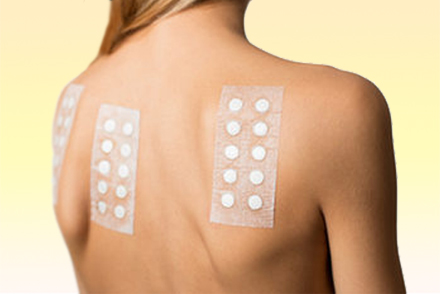 Кожные пробы Тест на аллергены