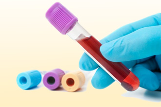 Всегда ли при аллергии нужны анализы? Всегда ли при аллергии нужны анализы?