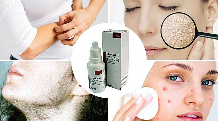 При использовании "Дипросалика" могут развиваться побочные эффекты Дипросалик