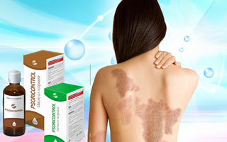 Препарат "PsoriControl" PsoriControl