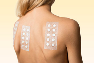 Для постановки диагноза проводят кожные пробы Кожные пробы