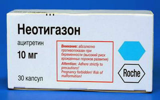 Препарат "Неотигазон" Препарат