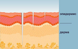 Толщина эпидермиса Как работает