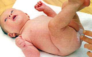 Пеленочный дерматит в области анального отверстия Симптомы болезни