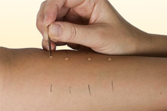 Что такое поливалентная аллергия? Что такое поливалентная аллергия?