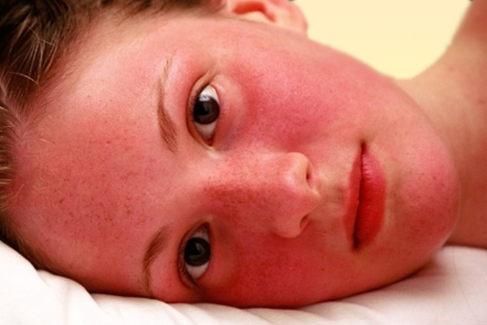 Пораснение кожи и зуд на лице Раздражение кожи лица