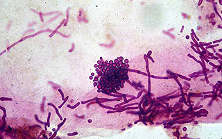 Грибок Malassezia furfur Malassezia furfur